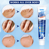 Load image into Gallery viewer, WartsOff Instant Blemish Removal Cream