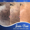 Anti-Freckle & TagOut Mole Removal Cream